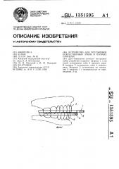 Устройство для постановки искусственных зубов в полных протезах (патент 1351595)