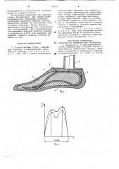 Искусственная стопа (патент 778732)