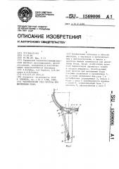 Тазобедренный узел протеза при вычленении бедра (патент 1569006)