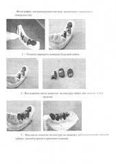 Контролируемый способ подготовки спаиваемых поверхностей несъемных зубных протезов (патент 2657191)