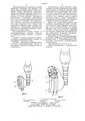 Способ резекции щитовидной железы (патент 1242129)