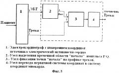 Способ повышения точности при измерении координат сигналов миокарда и устройство его реализации (патент 2535439)