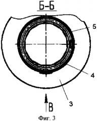 Сетчатый фильтр (патент 2359738)