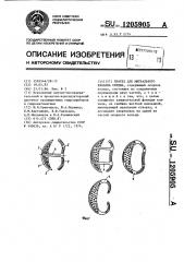Протез для митрального клапана сердца (патент 1205905)