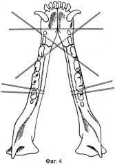 Способ остеосинтеза нижней челюсти животных (патент 2404725)