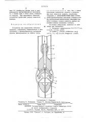 Устройство для разрушения венозных клапанов (патент 537676)