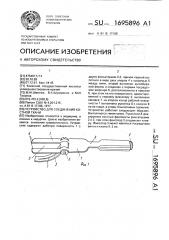 Устройство для соединения костной ткани (патент 1695896)