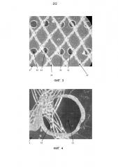 Устройства для восстановления ткани с быстрым впитыванием терапевтических средств (патент 2608461)