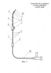 Устройство для исследования и лечения заболеваний слуховой трубы (патент 2615273)