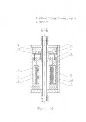Перистальтический насос (патент 2622221)