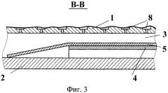 Упорный подшипниковый узел (патент 2449184)