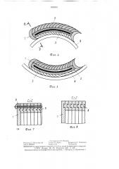 Кассета для рентгеновской пленки (патент 1420591)