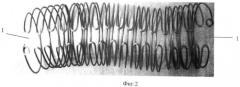 Способ замещения протяженного циркулярного дефекта трахеи (патент 2449740)