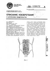 Способ лечения нейрогенного мочевого пузыря (патент 1158172)