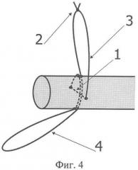 Способ наложения петлевого сухожильного шва по власову м.в. (патент 2346665)