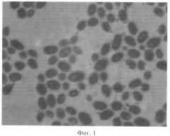 Штамм saccharomyces cerevisiae ts2-06, используемый для изготовления бактериальных препаратов и производства жидкой молочнокислой закваски в качестве продукта питания лечебно-профилактического назначения (патент 2391394)