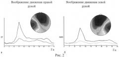 Способ реабилитации больных, перенесших инсульт (патент 2523349)