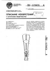 Протез голени на укороченную конечность (патент 1175473)