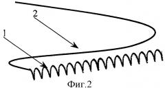 Дренаж мочевых путей (патент 2300399)