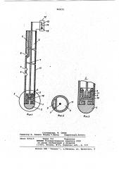 Устройство для зондирования кишечника (патент 969275)