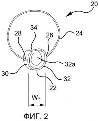 Вспомогательное центрирующее устройство для имплантируемой петли (патент 2540167)
