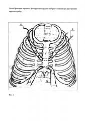 Способ фиксации переднего флотирующего грудино-реберного клапана при двусторонних переломах ребер (патент 2621871)