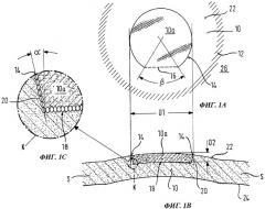 Аппарат для вырезания части ткани сфокусированным лазерным излучением (патент 2480189)