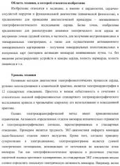 Способ неинвазивного электрофизиологического исследования сердца (патент 2417051)