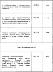 Способ липотерапии (патент 2610006)