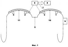 Устройство для снятия цветного изображения передней части глаза человека (варианты) (патент 2291662)