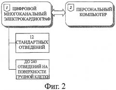 Способ неинвазивного электрофизиологического исследования сердца (патент 2435518)