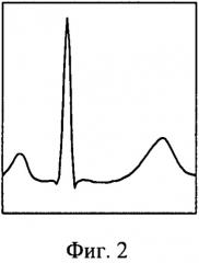 Способ обработки электрокардиосигнала (патент 2503401)