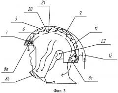 Устройство для коррекции церебральной гипертермии (патент 2615283)