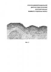 Способ дифференциальной диагностики опухолей аногенитальных маммароподобных желез (патент 2626123)