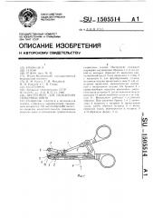 Инструмент для наложения скобочных швов (патент 1505514)