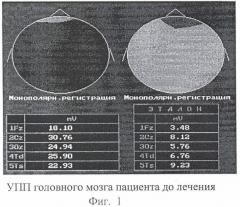 Фармацевтическая композиция, включающая холина альфосцерат и гопантеновую кислоту (или ее соль), для лечения недостаточности кровообращения мозга и эректильной дисфункции (патент 2391095)