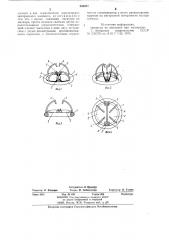 Протез клапана сердца (патент 843977)