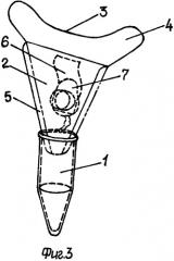 Устройство для сбора слезной жидкости (патент 2335233)