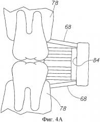 Способы для ухода за полостью рта (патент 2379069)