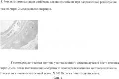 Мембрана для использования при направленной регенерации тканей (патент 2367475)