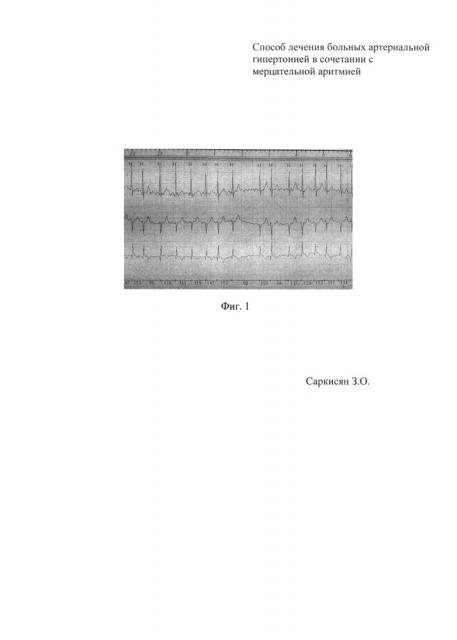 Способ лечения больных артериальной гипертонией в сочетании с мерцательной аритмией (патент 2630718)