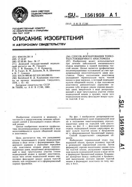 Способ формирования тонко-толстокишечного анастомоза (патент 1561959)