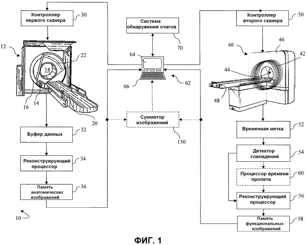 Построение анатомической модели для обозначения границ представляющей интерес опухолевой области (патент 2544479)