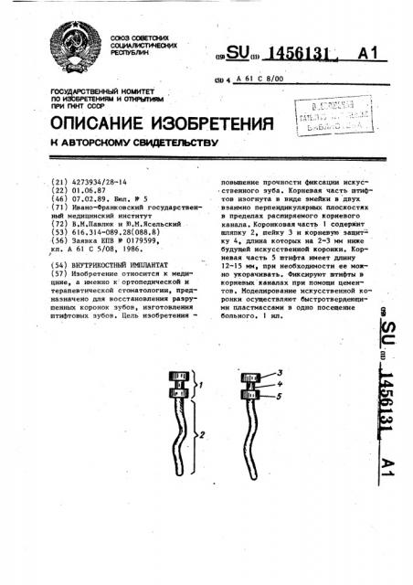 Внутрикостный имплантат (патент 1456131)