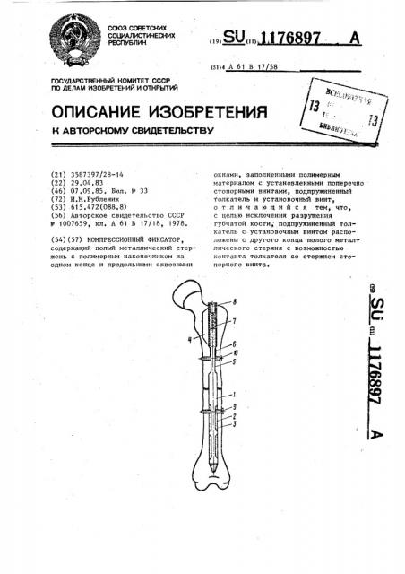 Компрессионный фиксатор (патент 1176897)