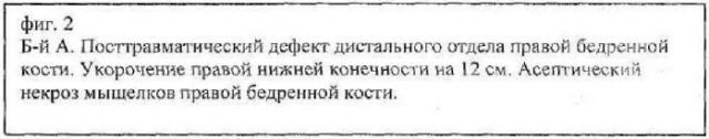 Способ лечения обширных дефектов дистального отдела бедренной кости и коленного сустава посттравматического происхождения (патент 2463983)