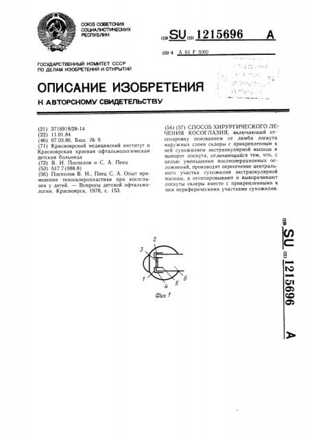 Способ хирургического лечения косоглазия (патент 1215696)