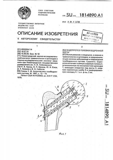 Эндопротез головки бедренной кости (патент 1814890)