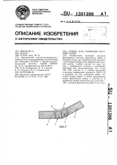 Скобка для сшивания костной ткани (патент 1301386)