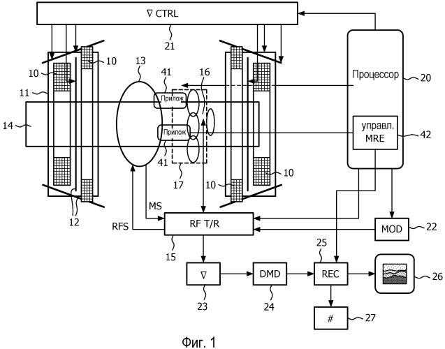 Магниторезонансная эластография (патент 2536113)